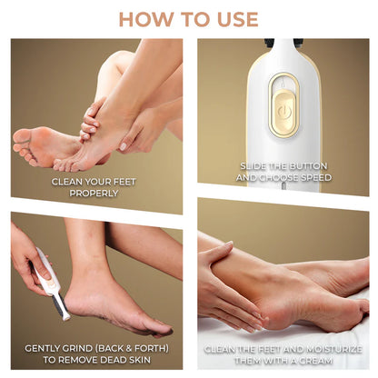 Rechargeable Callus Remover